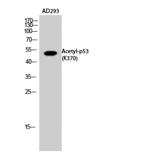 Polyclonal Rabbit anti-Human TP53 / p53 Antibody (acetylation site of K370., WB)