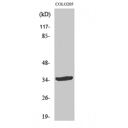 Polyclonal Rabbit anti-Human YOD1 Antibody (90-170 aa, Internal, WB)