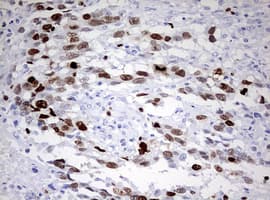 TOP2A / Topoisomerase II Alpha Antibody (aa1100-1531, clone OTI1D5)