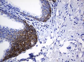 Monoclonal Mouse anti-Human NDUFB10 Antibody (clone OTI2G1, IHC, WB)