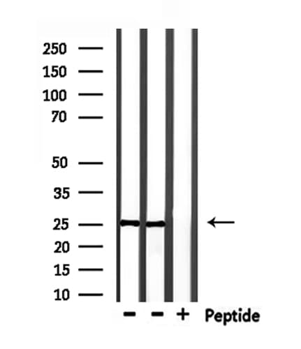 RAB28 Antibody