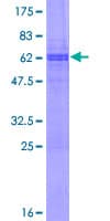 Human SRCIN1 / SNIP Protein (Recombinant GST)