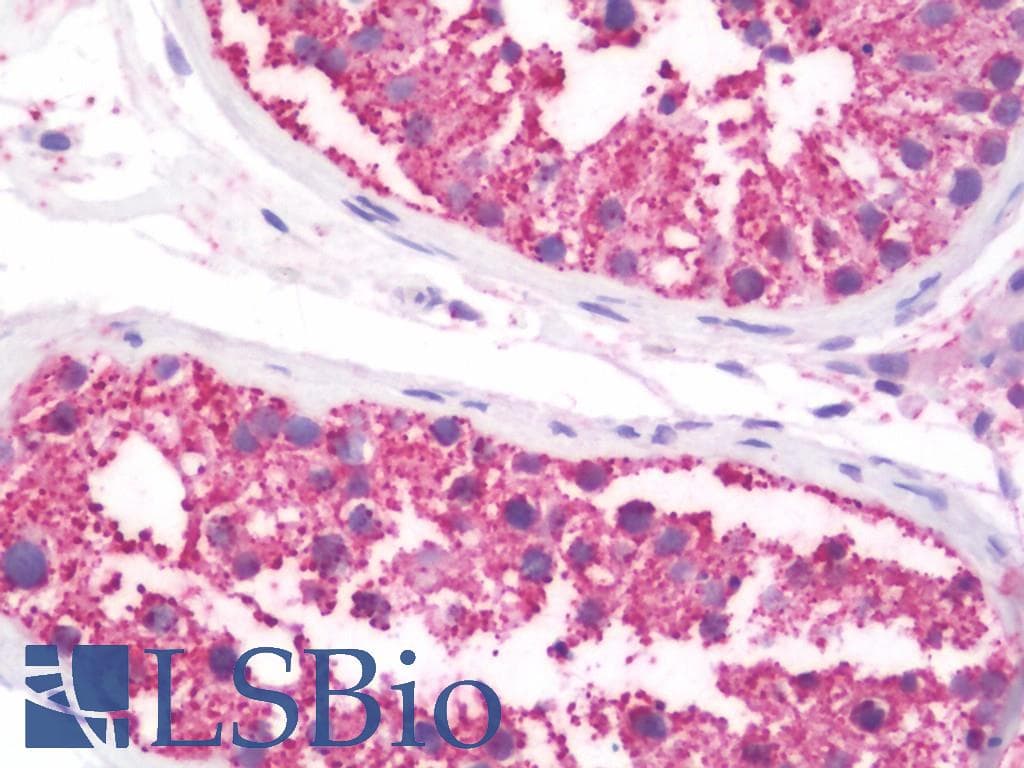 IHC-plus™ TNFRSF1A / TNFR1 Antibody (aa20-43)