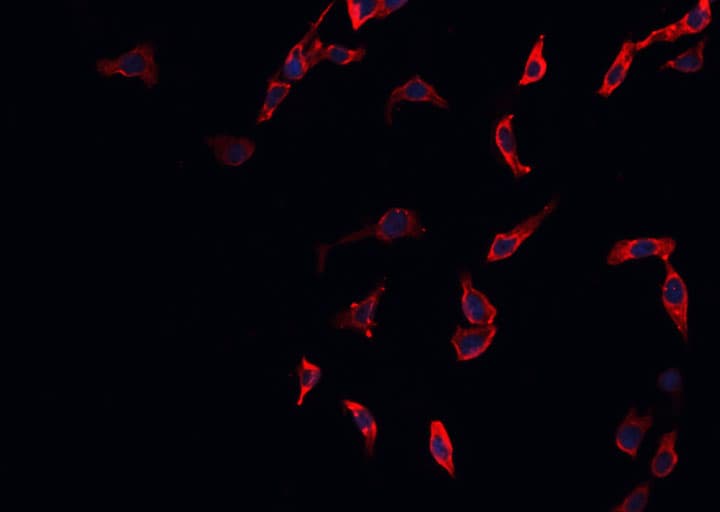 Polyclonal Rabbit anti-Human CDC37 Antibody (IHC, IF, WB)