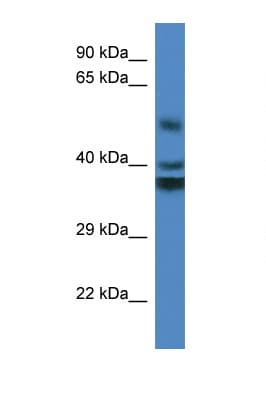 RTN4IP1 / NIMP Antibody (aa188-237)