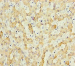 Polyclonal Rabbit anti-Human SCEH / ECHS1 Antibody (IHC, WB)
