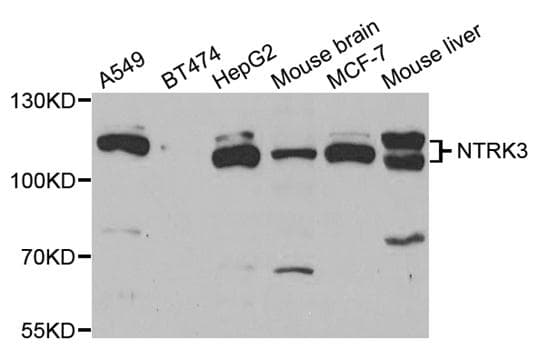IHC-plus™ NTRK3 / TRKC Antibody