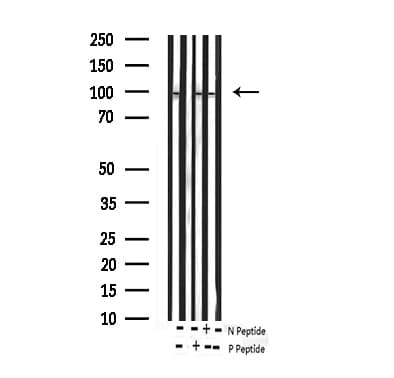 Polyclonal Rabbit anti-Human FOXO3 / FOXO3A Antibody (phospho-Ser253, IHC, WB)