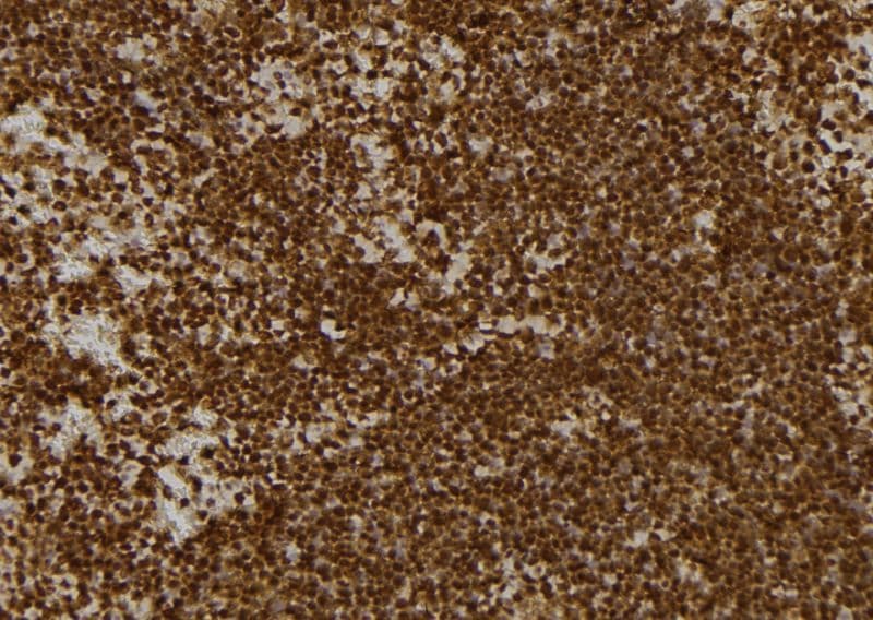 KBTBD3 Antibody