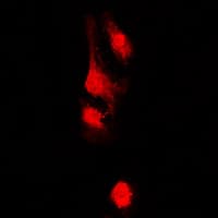 LBC / AKAP13 Antibody (Internal)