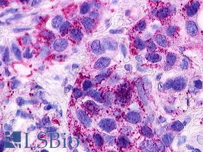 PathPlus™ Polyclonal Rabbit anti-Human S1PR1 / EDG1 / S1P1 Antibody (C-Terminus, IHC)
