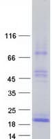 Human TSHB / TSH-Beta Protein (Recombinant Myc-DDK (Flag))