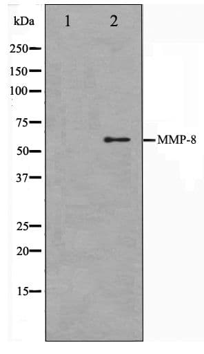 Polyclonal Rabbit anti-Human MMP8 Antibody (IHC, WB)