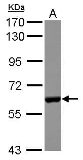 CES2 / Esterase Antibody
