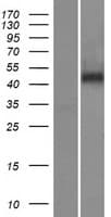 SERPINA4 / Kallistatin Protein (Over-Expression Lysate Myc-DDK (Flag))
