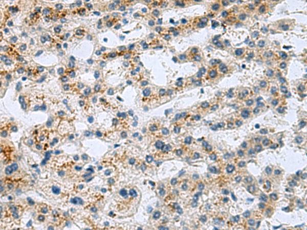 GHRHR Antibody