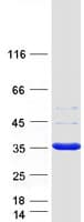 Human SULT1A1 / Sulfotransferase 1A1 Protein (Recombinant Myc-DDK (Flag))