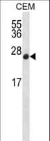 CDKN2B / p15 INK4b Antibody (aa103-131)