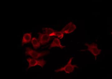 Polyclonal Rabbit anti-Human OR8B4 Antibody (IF, WB)