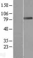 PODN Protein (Over-Expression Lysate Myc-DDK (Flag))