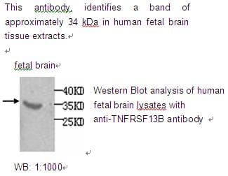 TNFRSF13B / TACI Antibody