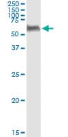 PEPD / PROLIDASE Antibody (clone 1D5-H3)