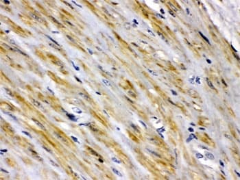 I-FABP / FABP2 Antibody