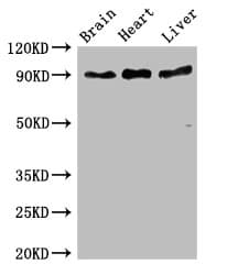 RPS6KA5 / MSK1 Antibody