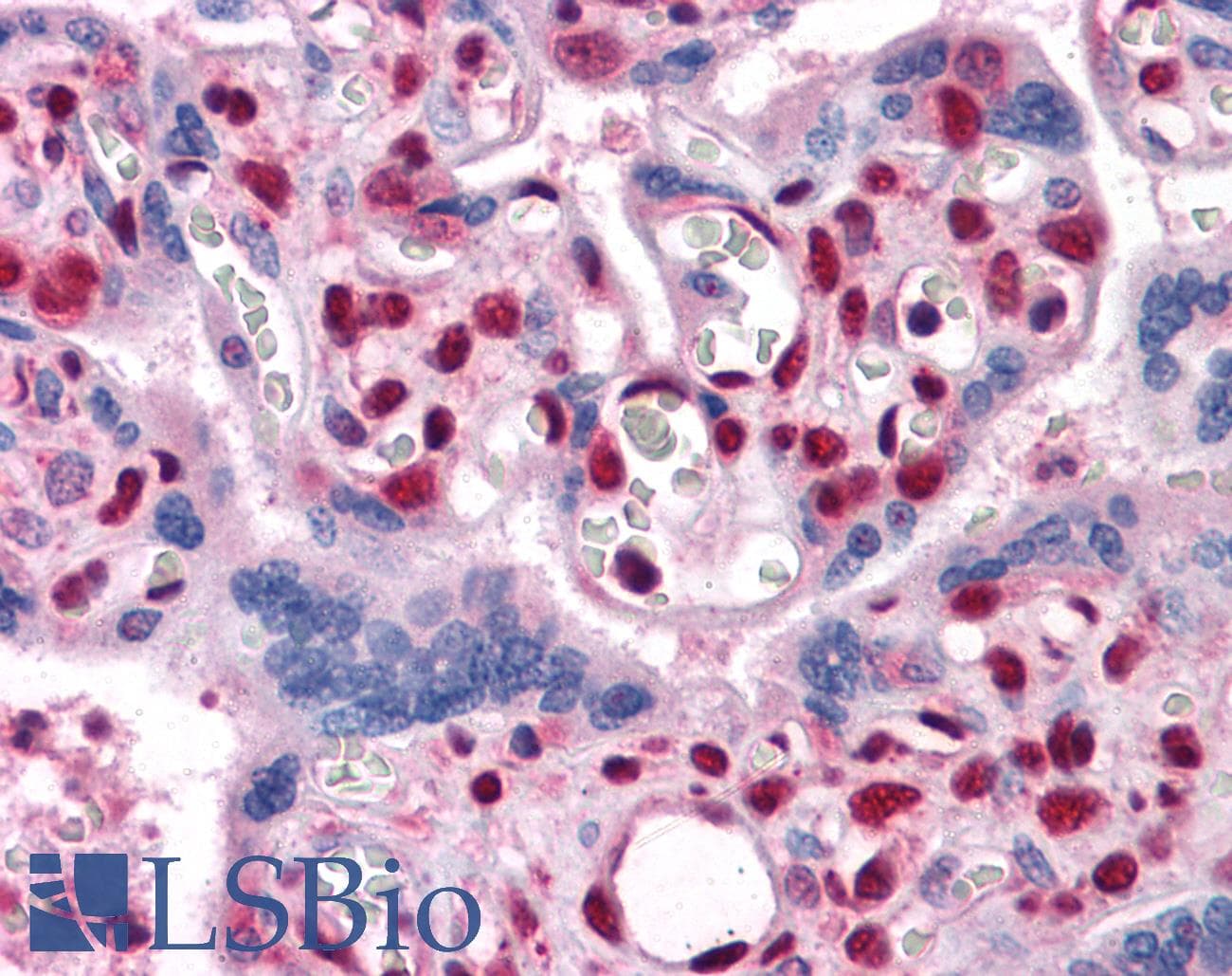IHC-plus™ MUM1 Antibody (clone 4G10)