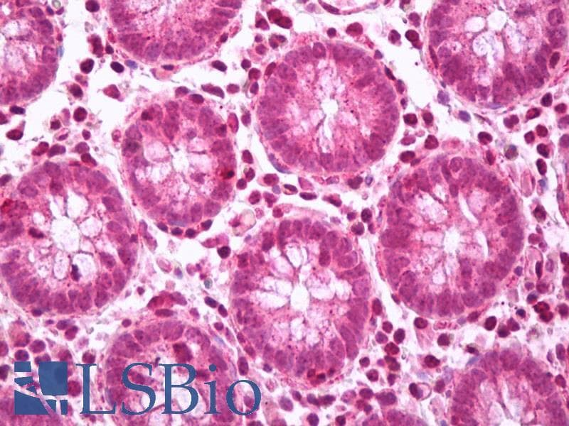 IHC-plus™ FAK / Focal Adhesion Kinase Antibody (aa706-1052)