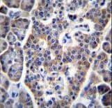 SIP / TP53INP1 Antibody (aa181-210)