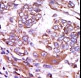 CAMK2D / CaMKII Delta Antibody (aa448-478)