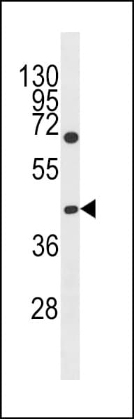 GCNT6 Antibody (aa276-302)