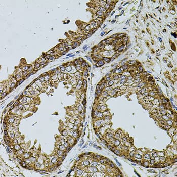 Polyclonal Rabbit anti-Human UQCRC1 Antibody (IHC, WB)