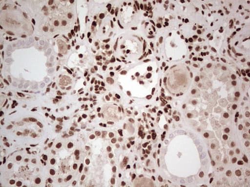 NR3C1/Glucocorticoid Receptor Antibody (aa1-265, clone OTI6A12)