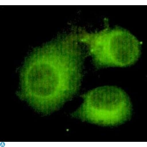 Monoclonal Mouse anti-Human ACLY / ATP Citrate Lyase Antibody (IF, WB)