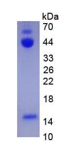 Human INHBA / Inhibin Beta A Protein (Recombinant)