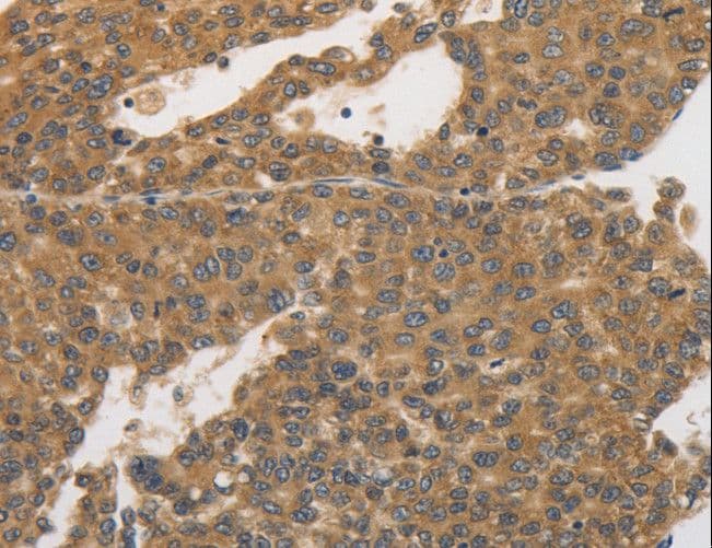 PRKD1 / PKC Mu Antibody