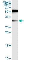 RAG2 / RAG-2 Antibody (clone 2G8)