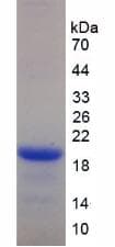 Human KLRD1 / CD94 Protein (Recombinant His-T7)