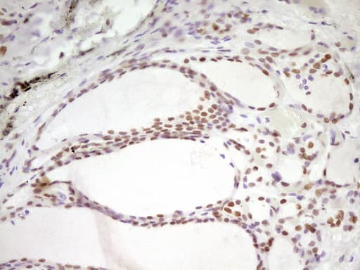 HMG20A Antibody (aa1-281, clone OTI2H4)