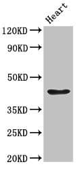 Polyclonal Rabbit anti-Human PARVA Antibody (IHC, IF, WB)