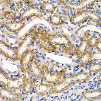 ZFAND3 / TEX27 Antibody