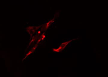 UBASH3A / CLIP4 Antibody