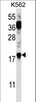 PTMS / Parathymosin Antibody (aa72-102)