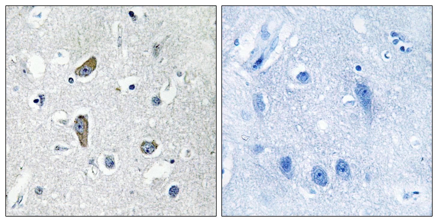Polyclonal Rabbit anti-Human CDK5RAP2 Antibody (IHC)