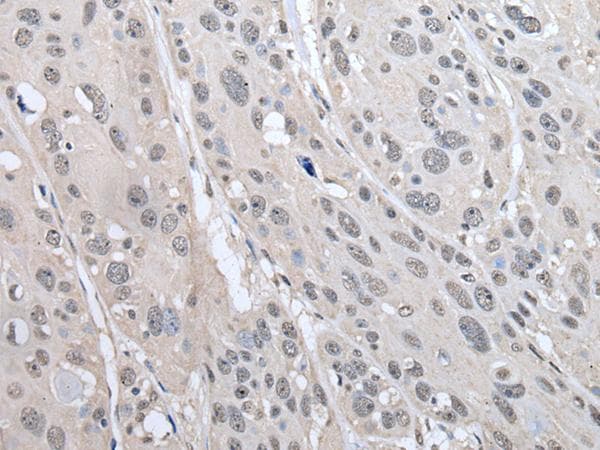 PRAME Antibody