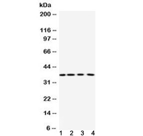 PNP / Nucleoside Phosphorylase Antibody