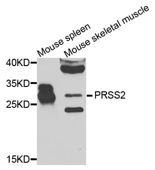 PRSS2 / Trypsin 2 Antibody