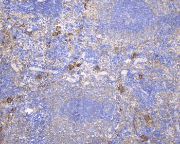 LY9 / CD229 Antibody